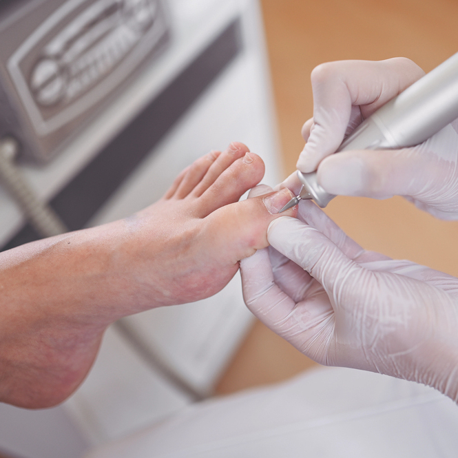 Fusspflege Donzdorf - fusspflege